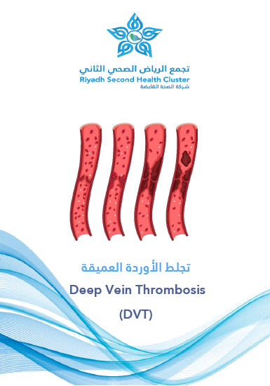 HEM1.18.000619 Deep Vein Thrombosis (DVT).pdf
